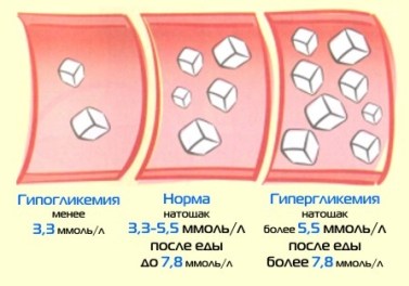 Сахар в крови